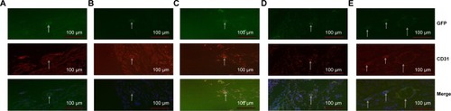 Figure 11 Homing of BMSCs to the wounds.Notes: Mice in groups A–E were treated as above but were also injected with 5 × 105 GFP-BMSCs intravenously at the same time. Immunofluorescence showed that mice that received SDF1α-PPADT nanoparticles contained more GFP, CD31 double-positive cells than mice in the other four groups. The arrows point to green dots which are BMSCs that are labeled by GFP, red dots which are vascular endothelial cells that are labeled by the CD31 antibody, and blue dots which is the nucleus that is labeled by DAPI.Abbreviations: GFP, green fluorescent protein; CD31, platelet endothelial cell adhesion molecule-1; SDF-1α-PPADT, SDF-1α-loaded PPADT; SDF-1α, stromal cell-derived factor-1α; PPADT, poly-(1,4-phenyleneacetone dimethylene thioketal).