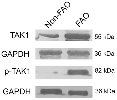 Figure 2 The levels of TAK1 and p-TAK1 in total sputum cells was analyzed by Western blot analysis of whole cell lysate from asthmatics with FAO and without FAO (non-FAO). GAPDH served as the standard.
