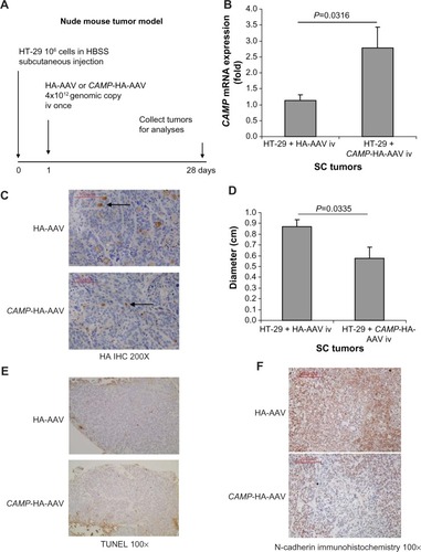 Figure 1 Intravenous cathelicidin expressing AAV administration inhibited EMT in HT-29-derived subcutaneous tumors in nude mice. (A) Experimental plan. (B) Human cathelicidin mRNA expression in subcutaneous tumors. The CAMP-HA-AAV expressed human cathelicidin mRNA in tumors. (C) Immunohistochemistry of HA tag. AAV-mediated infected cells were stained by HA antibody and appeared brown. The extent of infection was similar among tumors from the HA-AAV and CAMP-HA-AAV groups. (D) Diameters of subcutaneous tumors. Intravenous CAMP-HA-AAV significantly reduced subcutaneous tumor diameter in nude mice. (E) TUNEL staining. Apoptotic cells should be staining with intense brown color. There was no apoptosis in the cathelicidin-expressing and control groups. (F) Immunohistochemistry of N-cadherin. N-cadherin-positive cells were identified by brown color staining. Intravenous cathelicidin-expressing AAVs reduced mesenchymal cell marker N-cadherin expression in the subcutaneous tumors.