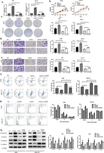 Figure 4. MiR-30c-2-3p represses malignant progression of GA via modulating ARHGAP11A. a: The transfection effects of over-expressed ARHGAP11A. b-c: Impact of the co-transfection of miR-30c-2-3p and ARHGAP11A on AGS cell proliferation. d-e: Motility of GA cells with over-expressed miR-30c-2-3p and ARHGAP11A (magnification: 100×). f: The apoptosis rate of AGS cells with over-expressed miR-30c-2-3p or ARHGAP11A vector. g: Cell cycle distribution of AGD and HGC-27 cells following transfection of over-expressed miR-30c-2-3p and ARHGAP11A. h: EMT-related proteins in AGS cells with over-expressed miR-30c-2-3p or ARHGAP11A. * P < 0.05, # P < 0.05.