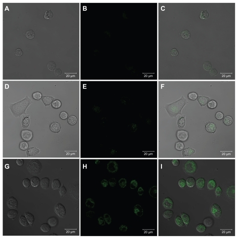 Figure 6 Confocal microscopic images of KB-HFAR cells incubated with phosphate-buffered saline buffer (A, B, and C), KB-LFAR cells (D, E, and F), and KB-HFAR cells (G, H, and I) treated with G5.NHAc-FI-FA/CA4 complexes. Differential interference contrast images (left panels), fluorescent images (middle panels), and merged images with the above two modes (right panels) were collected under similar instrumental conditions.Abbreviations: G5, generation 5; G5.NHAc-FI-FA, fluorescein isothiocyanate-modified and folic acid-modified G5 PAMAM dendrimers with acetyl terminal groups; CA4, combretastatin A4; HFAR, high folic acid receptor levels; LFAR, low folic acid receptor levels.