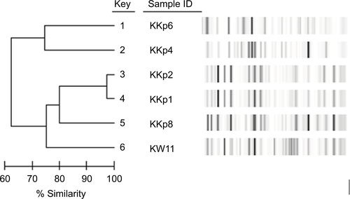 Figure S2 rep-PCR comparison of Kuwaiti Klebsiella pneumoniae strains.Abbreviation: rep-PCR, repetitive element sequence-based polymerase chain reaction.