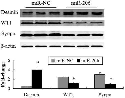 Figure 7. miR-206 promote podocyte damage. The expression of desmin significantly increased, while WT1 and synaptopodin were suppressed by transfection with miR-206 mimics compared with the miR-NC group. The intensities of the protein bands were quantified and normalized to β-actin. *p < 0.05 indicate statistically significant compared with the miR-NC group.