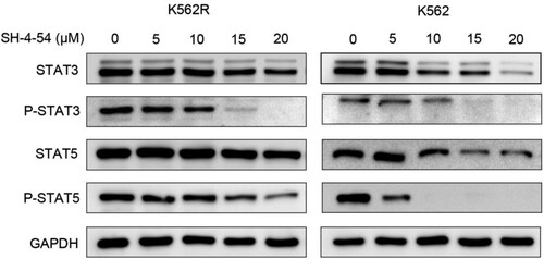 Figure 4. Effects of SH-4-54 on the expression of proteins downstream of BCR-ABL in CML cells. K562 and K562R cells were treated with 0, 5, 10, 15, 20 μM SH-4-54 for 3 h. Then, whole-cell lysates were extracted to assess the levels of STAT3, pSTAT3, STAT5, pSTAT5 by Western blot analysis. GAPDH was used as a loading control. The results are representative of three determinations with identical results.