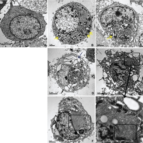 Figure 4 TEM of HUVECs incubated with IONPs for one hour, (×8000 magnification).Notes: (a) control cell (without incubation of any particles); (b, d, f) with citrate-IONP; (c, e, g) with dextran-IONP; (b, c) cells were incubated with IONPs at iron concentration of 0.1 nM; (d–g) cells were incubated with IONPs at iron concentration of 1 nM; (b, c) Particles were taken up into lysosomes; (d, e) Many vacuoles could be found in cytoplasm; (f, g) Abnormal dense filament matter appeared adjacent to vacuoles (yellow arrow: IONPs, black arrow: vacuoles, rectangular: filaments, L: lysosome).Abbreviations: IONP, iron oxide nanoparticles; TEM, transmission electron microscope; HUVECs, human umbilical vein endothelial cells.