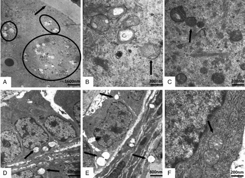 Figure 3.  Transmission electron microscopic images of the intra-ovarian oocytes (A-C) and the granulosa cells (D-F) in ovaries. Compared to the control (C, F, ×40,000), the mitochondrial vacuolization (A; ×5,000) and the swollen mitochondria with distorted cristae (B; ×40,000) in ovarian oocytes, and the mitochondrial vacuolization in granulosa cells (D, E; ×10,000) were observed in the 20 mg/L (A, D) and 40 mg/L (B, E) group. The arrow indicated the zona pellucida in A, and the arrows or cycle indicated the mitochondria in B-F.