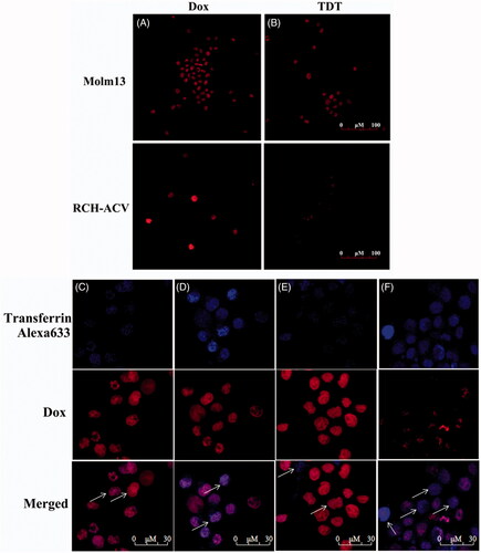 Figure 5. Dox’s selective delivery by TDT to CD123 + tumor cells (Molm-13) and monitoring of intracellular drug unloading via endocytosis/lysosome pathway. (A,B) Confocal laser scanning microscopy images of Molm-13 (A) and RCH-ACV cells (B) after incubation with free doxorubicin or TDT for 4 hours. (C–F) Confocal laser scanning microscopy images of TDT-mediated selective drug delivery to CD123 + tumor cells via endocytosis/lysosme. CD123 + Molm-13 cells (C and D) and CD123− RCH-ACV cells (E and F) were treated either with free Dox (C and E; 2 mM) or TDT (D and F; 2 mM Dox equivalents) for 2 h, followed by transferrin-Alexa 633 staining (arrows indicated probative cells; Scale bar: 30 μm).
