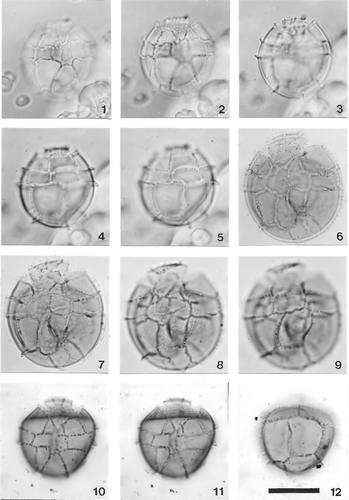 Plate 1. Microdinium ornatum Cookson & Eisenack. Photomicrographs of Cookson & Eisenack's published specimens (re-photographed and provided by Robin Helby; scale bar (figure 12) for all figures = 25 µm. 1–5. Focus series through holotype (see Cookson & Eisenack Citation1960, pl. 2, figs 3, 4) in ventral view. Figures 1 and 2, ventral focus; figure 3, optical section; figures 4 and 5, dorsal focus. (?)Upper Albian to Cenomanian, Perth Basin, Western Australia. 6–9. Focus series through a specimen in ventral view (previously illustrated in Cookson & Eisenack Citation1971, pl. 7, fig. 7). High (figure 6) and slightly lower (figure 7) focus levels of ventral surface; optical section (figure 8) and dorsal focus (figure 9). Cretaceous (undiff.), Eucla Basin, Western Australia. 10–12. Three focus levels of a specimen in dorsal view (previously illustrated in Cookson & Eisenack Citation1971, pl. 7, figs. 8, 9). Figure 10, ventral focus; figure 11, ventral focus at slightly higher level than figure 10; figure 12, dorsal focus. Cretaceous (undiff.), Eucla Basin, Western Australia.