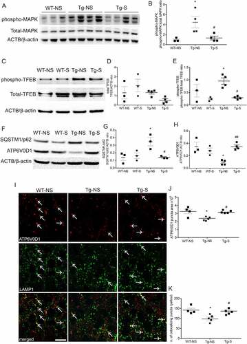 Figure 4. Synaptic activation restores levels of ATP6V0D1 and its lysosomal localization. (A, B) Western blot analyses showed higher (369 ± 120%) levels of phospho-MAPK in Tg-NS compared to WT-NS hippocampi; DBS restored levels of phospho-MAPK in Tg-S mice back to WT-NS levels (n = 3,4; one-way ANOVA test, p = 0.022, followed by Tukey’s multiple comparison post-hoc test: WT-NS vs Tg-NS *p < 0.05; Tg-NS vs Tg-S #p < 0.05). (C-E) Levels of phospho-TFEB (upper panel) were reduced by 69 ± 3% and 75 ± 4% in Tg-S and WT-S, respectively, compared to Tg-NS 3xTg mouse hippocampi (E), while levels of total TFEB (D) remained unchanged (n = 3–4; one-way ANOVA p = 0.0093, Tukey’s multiple comparison test: WT-S vs Tg-NS #p < 0.05, Tg-NS vs Tg-S #p < 0.05). (F, G) Levels of SQSTM1/p62 were increased by 150 ± 39% in Tg-NS compared to WT-NS mouse hippocampi, while in Tg-S levels of SQSTM1/p62 were restored back to WT-NS (n = 3; one-way ANOVA p = 0.0154, Tukey’s multiple comparison test: WT-NS vs Tg-NS *p < 0.05, Tg-NS vs Tg-S #p < 0.05). (F, H) Levels of ATP6V0D1 were decreased of 54 ± 6% in Tg-NS compared to WT-NS mouse hippocampi, while in Tg-S levels of ATP6V0D1 were restored back to WT-NS (n = 3–4; one-way ANOVA p = 0.002, Tukey’s multiple comparison test: WT-NS vs Tg-NS *p < 0.05; Tg-NS vs Tg-S ##p < 0.01). (I-K) Confocal immunofluorescence showed that Tg-NS hippocampal neurons had a 26 ± 4% decrease in size puncta areas of ATP6V0D1 (upper panels) compared to WT; DBS was able to restore ATP6V0D1 puncta areas in Tg-S back to WT-NS mice (n = 4–5; one-way ANOVA test p = 0.0184 followed by Tukey’s multiple comparison test WT-NS vs Tg-NS *p < 0.05, Tg-NS vs Tg-S #p < 0.05). Quantification of ATP6V0D1 and LAMP1 colocalization (lower panels, white arrows) revealed a 31 ± 7% decrease of colocalizing puncta in Tg-NS compared to WT-NS. DBS restored the number of ATP6V0D1 and LAMP1 colocalizing puncta in Tg-S hippocampal neurons back to WT-NS (n = 4–5; one-way ANOVA p = 0.0096 followed by Tukey’s multiple comparison test: WT-NS vs Tg-NS *p < 0.05, Tg-S vs Tg-NS #p < 0.05; scale bar: 10 μm).