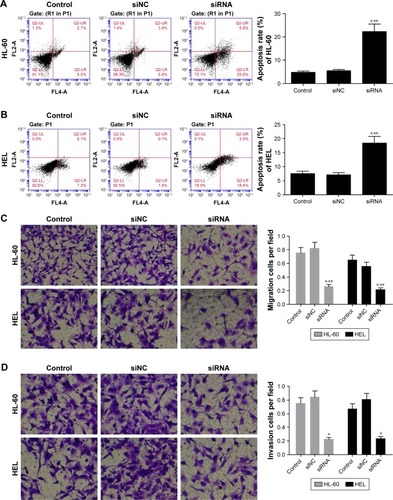 Figure 3 PDIA3 siRNA induces cell apoptosis and inhibits cell migration and invasion.