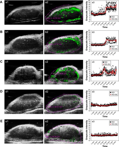 Figure 9 In vivo US imaging data using 50-MHz probe of MCF-7 orthotopic tumor from nude mice pre (a1–e1) and after (a2–e2) intravenous injection of DNCs (A), VNCs (B), PNCs (C), CNCs (D) and NNCs (E); (a3–e3) show the time-intensity curves.Notes: CNCs, free antibodies pre-treated before DNCs application; DNCs, dual-targeted gold nanoshelled poly(lactic-co-glycolic acid) nanocapsules carrying anti-vascular endothelial growth factor receptor type 2 antibody and anti-p53 antibody; NNCs, non-targeted gold nanoshelled poly(lactic-co-glycolic acid) nanocapsules; PNCs, single-targeted gold nanoshelled poly(lactic-co-glycolic acid) nanocapsules carrying anti-p53 antibody; VNCs, single-targeted gold nanoshelled poly(lactic-co-glycolic acid) nanocapsules carrying anti-vascular endothelial growth factor receptor type 2 antibody; ROI (the region of interest), the red oval region in a2-e2.