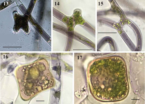 Fig. 13-17. Fig. 13 Filament in early stages of scalariform conjugation with dark purple colour (LM); Figs 14–15. Scalariform conjugation, detail of short cells and different colour and conjugation tube (LM); Figs 16–17. Young zygospores in surface view of quadrangular shape and quadrangular with rounded angles (LM). Figs 13–17 Scale bar = 50 μm