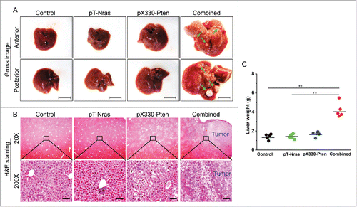 Figure 2. Pten disruption was synergized by Nras activation in driving liver tumor development. Liver samples from 5 mice in each group were collected 16 weeks after hydrodynamic plasmid injection. (A) Representative images of livers injected with different plasmids. Nodules are indicated by arrows; Bar = 1 cm. (B) Representative images of H&E staining of liver sections. Scale bar = 50 μm. (C) Liver weight. ** P < 0.01 compared with the control. ## P < 0.01 compared with mice injected with pT-Nras.