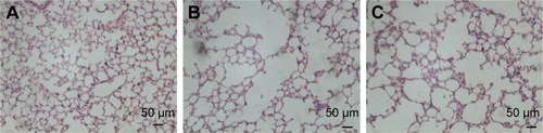 Figure 2 Histological examination of lungs in experimental groups (HE staining).Notes: (A) PBS group; (B) CSE group; (C) CSE + adenovirus group. Magnification ×100.Abbreviations: HE, hematoxylin and eosin; PBS, phosphate-buffered saline; CSE, cigarette smoke extract.