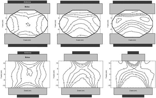 Figure 6. E-field distributions of the different antenna combinations at zero phase. From left to right: The contour plots of the 20 × 34 + 20 × 34 cm, 20 × 34 + 15 × 34 cm and 20 × 34 + 8.5 × 34 cm antenna combinations. The first row shows the field distributions in the transversal XY-plane and on the second row shows the distributions in the sagittal YZ-plane (Figure 3). The Z-component of the E-field in the centre of the phantom was normalised to 100%.