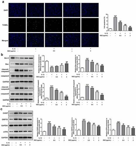 Figure 3. DEZ attenuated the apoptosis and ERS in IL-1β induced HNPCs. (a) Cell apoptosis was tested by TUNEL staining. (b) Western blot was executed for assessing the levels of apoptosis-related proteins. (c) The levels of ERS-related proteins were evaluated with Western blot assay. ***P < 0.001 vs. untreated group; #P < 0.05, ##P < 0.01, ###P < 0.001 vs. IL-1β group.