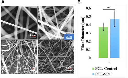 Figure 1 Scanning electron microscope (SEM) analysis. (A) SEM images of PCL-Control and PCL-SPC at 5 and 20 kx magnifications. (B) Comparative study of fiber diameter of synthesized electrospun mats. Data are presented as mean±SD.
