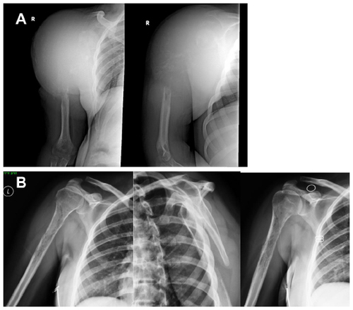 Figure 6 Space occupying lesions.