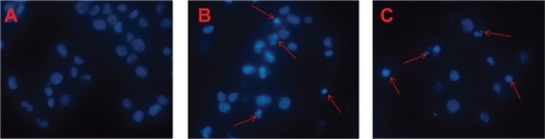 Figure 1 The morphological characteristics of apoptosis in K562/A02 cells incubated for 48 hours. (DAPI staining, ×100). A) Control; B) DNR/Br Tet-Sol; C) DNR/Br Tet-MNPs. Arrows indicate cells with apoptotic nuclear condensation and fragmentation.Abbreviations: DNR/Br Tet-Sol, daunorubicin and 5-bromotetrandrin in solution; DNR/Br Tet-MNPs, daunorubicin and 5-bromotetrandrin in magnetic nanoparticles.