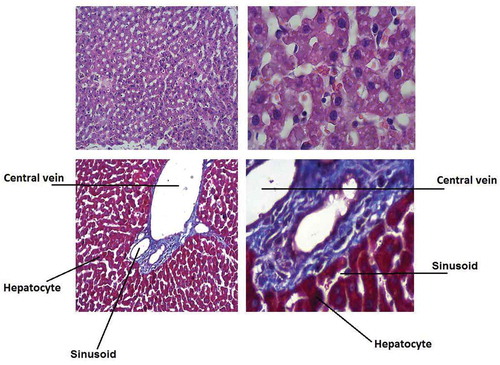 Figure 1. Microscopy of liver samples in control diabetic rats; (a) H&E (20 µm); (a) H&E (100 µm); (c) trichrome (20 µm); (d) trichrome (100 µm).