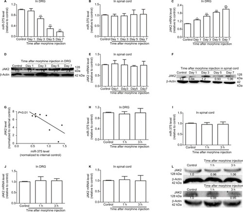 Figure 1 miR-375 level is downregulated and negatively correlated with JAK2 expression in DRG after chronic morphine treatment. (A and B) qRT-PCR is used to detect the levels of miR-375 in DRG (A) and spinal cord (B). (C and D) JAK2 mRNA and protein levels are examined by qRT-PCR and Western blot assays in DRG after chronic morphine treatment. (E and F) qRT-PCR and Western blot analysis are used to test the mRNA (E) and protein (F) levels of JAK2 in spinal cord after chronic morphine treatment. (G) qRT-PCR results show that miR-375 level is negatively correlated with JAK2 mRNA level in DRG following morphine treatment. (H and I) miR-375 level is detected in DRG (H) and spinal cord (I) after acute morphine treatment. (J–L) JAK2 mRNA and protein expression levels are examined in DRG (J and L upper) and spinal cord (K and L lower) following acute morphine treatment. Data were presented as mean ± SD; **P<0.01 vs. control.