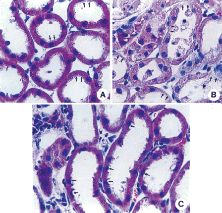 Figure 3. Effect of pentoxifylline (PTX) pretreatment on renal cortical morphological changes in cisplatin-injected rabbits. The animal was sacrificed 48 h after cisplatin injection. Normal rabbits did not receive any drug. Samples were stained with hematoxylin-eosin. In normal kidneys (A), proximal tubules show regular appearance in brush border (arrows) with normal cytoplasm and nucleus. In the animal treated with cisplatin, diffuse tubular necrosis was present in proximal tubules (arrows) (Fig. B). The morphology of proximal tubular cells in the PTX-pretreated animals was similar to the normal kidney, although cells with the loss of supranuclear cytoplasm were present (arrows) and brush-borders were irregularly arranged (Fig. C). Magnitude × 132. (Go to www.dekker.com to view this figure in color.)