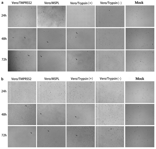 Figure 7. The cytopathic effects (CPEs) of Vero/TMPRSS2, Vero/MSPL, and Vero cells (without or with 3 μg/mL trypsin) incubated with PEDV isolates 2013-A and NJ. The Vero/TMPRSS2, Vero/MSPL, and Vero cells (without or with 3 μg/mL trypsin) were, respectively, incubated with PEDV isolates (2013-A and NJ) at an MOI = 0.01, followed by observation of CPEs. (a) CPEs observation of trypsin-dependent PEDV 2013-A at 24, 48, and 72 h post-infection; (b) CPEs observation of trypsin-dependent PEDV NJ at 24, 48, and 72 h post-infection. Arrows indicate syncytium.