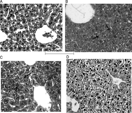 Figure 8. Histopathology of liver. (A) Vehicle control group showing normal arrangement of hepatocytes with clear nuclei (H&E; ×400). (B) Treatment with CP showing diffuse marked swelling of hepatocytes and narrowing of sinusoidal spaces of hepatocytes indicated by arrow (H&E; ×400). (C) Concomitant treatment with compound 4d showing mild swelling of hepatocytes indicated by arrow (H&E; ×400). (D) Pretreatment with 4d showing almost normal hepatocytes and normal architecture (H&E; ×400).