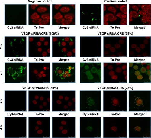 Figure 5 Confocal image (×104~105) of in vitro cellular uptakes of VEGF-siRNA/CRS at 2 h and 4 h.