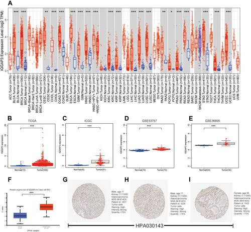 Figure 1 IQGAP3 were highly expressed in ccRCC samples. (A) IQGAP3 expression levels in different tumor types from TCGA database were determined by TIMER; (B–E) Data from TCGA, ICGC, GSE53757 and GSE36895 showed that IQGAP3 were highly expressed in ccRCC samples; (F) Based on the UALCAN database, we found that the expression levels of IQGAP3 protein were higher in ccRCC samples than that in normal renal tissues; (G–I) Representative immunohistochemical images derived from the HPA database showed that IQGAP3 protein was “high” immunohistochemical staining in ccRCC samples.