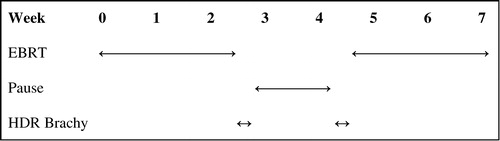 Figure 1. A schematic view of the treatment with two courses of EBRT (24 and 26 Gy respectively in 2 Gy fractions) and two HDR brachytherapy treatments of 10 Gy in the start and end of the interval.