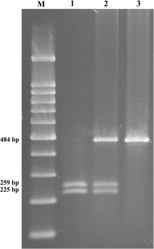 Figure 1 Detection of the Ile105Val (A to G transition) of GSTP1 by RFLP on 2% agarose gel. (M) 100 bp DNA ladder (CinnaGen co, Iran); lane 1: GSTP1 (Val/Val), lane 2: GSTP1 (Ile/Val); lane 3: GSTP1 (Ile/Ile).
