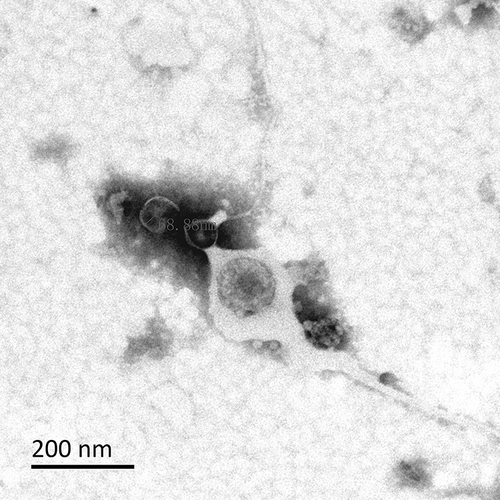 Figure 4 Observation of OMVs secreted by cKP under the transmission electron microscope.
