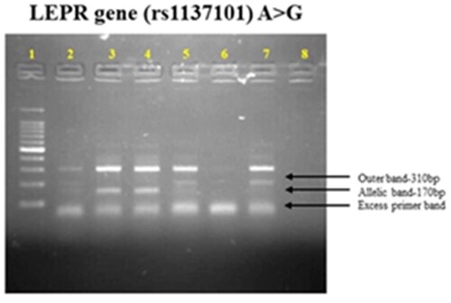 Figure 2. Genotype frequency by ARMS PCR for T2DM and controls.