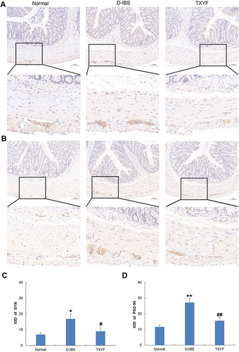 Figure 8 Effect of TXYF on the expression of synaptophysin (SYN) and postsynaptic density-95 (PSD-95) in the colon. (A) Immunohistochemical staining of SYN. (B) Immunohistochemical staining of PSD-95. (Scale bar 100μm). (C) Integrated optical density (IOD) of SYN in the colon. (D) Integrated optical density (IOD) of PSD-95 in the colon. *P < 0.05, **P < 0.01 vs Normal group, #P < 0.05, ##P < 0.01 vs D-IBS group. Data are presented as mean ± SEM (n=5).