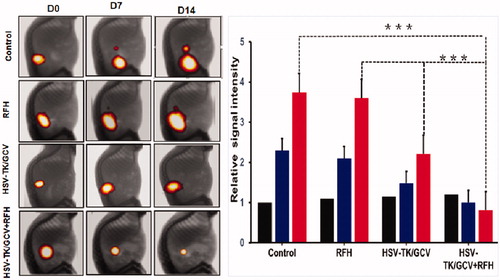 Figure 5. Four groups of nude rats with orthotopic ovarian cancer were treated with intratumoral PBS, RFH, HSV-TK/GCV gene therapy, and combination of both. Optical/X-ray images showed the bioluminescence signal of tumors. Compared to the other three groups treated with PBS, RFH, HSV-TK/GCV gene therapy alone, the combination therapy significantly retarded tumor growth, manifesting as a significant decrease in bioluminescence signals (red-yellow colors) (***p < .001).