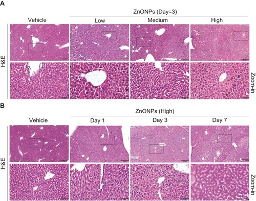 Figure 1 Pulmonary ZnONPs exposure caused the pathological changes in mouse liver. (A) After a single treatment of 3, 6, 12 μg/animal ZnONPs via tracheal instillation, H&E staining on liver tissues of mice showed a dose-related manner on pathological changes.(B) The mice were treated with 12 μg/animal ZnONPs via tracheal instillation, the liver tissues were collected at post-exposure day 1, day 3 and day 7. H&E staining was used to observe pathological changes. Scale bar = 200 μm in original figures or 50 μm in Zoom-in figures.