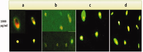Figure 4. Fluorescent microscope images of L. tropica promastigotes treated with extracts of selected callus and control samples at 1000 µg/mL using AO/EB staining. Where apoptotic cells (cells with orange to red nuclei/condensed chromatin), apoptotic bodies (cells with bright green color but smaller in size or dispersed bodies) are obvious: (a) callus extract established in response to BA plus 2,4-D, (b) callus extract established in response to 2,4-D, (c) control and (d) callus extract established in response to BA. The images were edited using ImageJ (iJ-150).