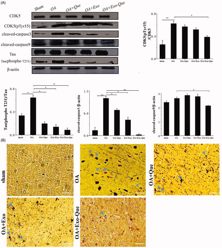 Figure 9. Analysis of Exo-Que on neuroprotective effects in OA-induced AD mice through inhibiting CDK5-mediated phosphorylation of Tau and reducing formation of insoluble neurofibrillary tangles. (A) Western blot and quantitative analysis of the expression levels of CDK5 phosphor-CDK5 (pTyr15), Tau, phosphor-Tau (T231), cleaved caspase3 and cleaved caspase9 in sham, OA, OA + Que, OA + Exo and OA + Exo-Que groups. Data are expressed as mean ± SD (n = 3), * p < 0.05, ** p < 0.01. (B) The images of NFTs (blue arrows) on brain section in sham, OA, OA + Que, OA + Exo and OA + Exo-Que groups. Scale bar: 50 μm.