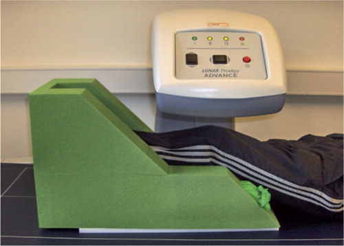 Figure 3. The constructed leg positioner of soft foam for clinical AP scans allowed a reproducible leg position of approximately 25° knee flexion and neutral rotation. The sides of the positioner were filled with rice.