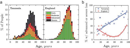 Figure 3. VF loss severity at first presentation as a function of age. (a) Histograms. In both datasets, patient ages followed similar (‘gumbel max’) distributions (blue dashed lines), though the median age was older in the England population (67 vs. 63 years). (b) Proportion of individuals with advanced loss, as a function of age. Lines indicate least-square polynomial spline fits to the data (NB: the point marked with the black cross was not included in this fit).