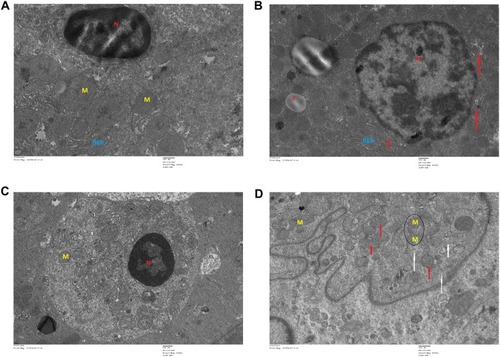 Figure 12 Transmission electron microscopy (TEM) images of different organs (A and B of liver, C and D of Kidney) of Wistar rats injected with different doses of IONPs and control. Liver ultrastructure shows nanoparticles (red arrows), fat globules (F), nucleus (N), mitochondria (M), rough endoplasmic reticulum (RER), glycogen granules (G), vesicles (V). (A) Control and (B) 30 mg/kg-treated group's liver image. (C) Control and (D) 30 mg/kg-treated group's kidney, vacuolization in cytoplasm (white arrows), damaged mitochondria (black circle), lysosomes (red arrows), mitochondria (M), and nucleus (N).