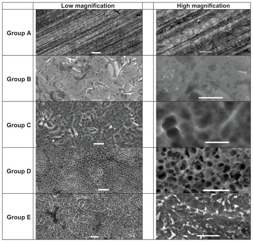 Figure 2 Scanning electron microscopy images of each sample.Note: Scale bars on the left represent 10 μm and scale bars on the right represent 5 μm.