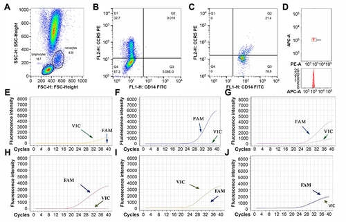 Figure 1 Determination of the expression level and gene polymorphism of RANTES and its CCR5 receptor. (A) Flow cytometry analysis of leukocytes in peripheral venous blood. (B) Flow cytometry analysis of CCR5 expression level on the surface of peripheral venous blood lymphocytes. (C) Flow cytometry analysis of the expression level of CCR5 on the surface of peripheral venous blood monocytes. (D) Flow cytometry analysis of plasma RANTES expression level in peripheral venous blood. (E–G) The PCR product fusion curves of the CCR5 gene rs1799987 AA genotype (E), the CCR5 gene rs1799987 GG genotype (F) and the CCR5 gene rs1799987 AG genotype (G). VIC=A, FAM=G. (H–J) The PCR product fusion curves of the RANTES gene rs2280788 CC genotype (H), the RANTES gene rs2280788 GG genotype (I) and the RANTES gene rs2280788 CG genotype (J). FAM=C, VIC=G.
