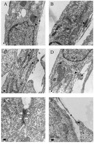 Figure 1. Representative specimens of transmission electron microscopy analysis. Cultured myofibroblasts from never-smokers (A,B), smokers (C,D) and COPD (E,F) were analyzed. On the left is a sample from peripheral lung and on the right, the central sample from the same patient. Dilated rough endoplasmic reticulum (arrow), extracellular component of fibronexus (asterix), intracellular actin belt (arrowhead) and adherens junction (white arrow) are indicated