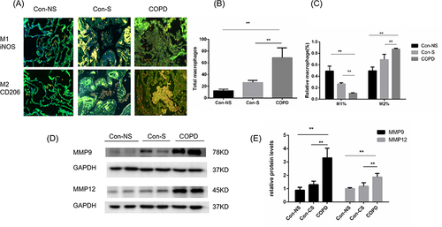 Figure 1 Increased M2 macrophage polarization in COPD patients. Con-NS, nonsmokers without COPD; Con-S, smokers without COPD; COPD, COPD patients. (A) Lung macrophages were observed by immunofluorescence analysis in the Con-NS (n=5), Con-S (n=4), and COPD (n=3) groups. Scale bars, 50 µm. CD68: green; iNOS: red; CD206: red. (B) Immunofluorescence analysis of the total number of AMs. (C) Quantification of the percentages of M2 and M1 macrophages among total macrophages. Total macrophages: CD68+. M1%: iNOS+/CD68+. M2%: CD206+/CD68+. (D) Western blots. (E) Relative protein levels of MMP9 and MMP12 in the lung. The data are the mean ± SD (n=5). **P < 0.01.