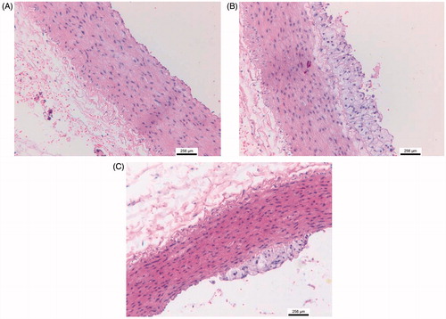 Figure 3. Histological photograph of rabbit aorta. (A) Photograph of thoracic aorta from a normal diet-fed rabbit. (B) Many foam cells observed from a high-fat diet rabbits. (C) Fewer foam cells observed from a ATP supplementation rabbit.