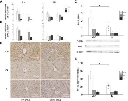 Figure 3 Activation of the TLR-3-NF-kB p65 pathway response in the liver. (A) Tlr-3 mRNA expression levels in the liver at 2 and 24 h. (B) Nf-κb p65 mRNA expression levels in the liver at 2 and 24 h. (C) P-IkBα/IkBα protein expression in the liver at 2 h. (D) Immunostaining of NF-κB p65 in the liver at 2 h. (E) Ratio of the NF-κB-positive nuclei in each area. *p < 0.05, Mann–Whitney U-test. Data are represented by mean ± SE. Number of dams = 4 in each group, number of pups = 8–9 in each group. P20, poly(I:C) 20 mg/kg; P4, poly(I:C) 4 mg/kg; S, saline.