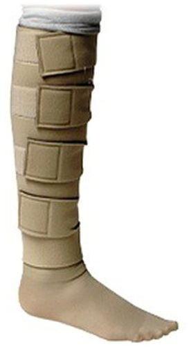 Figure 4 Compression with Velcro straps for self-adjustment to allow patient to control pressure.