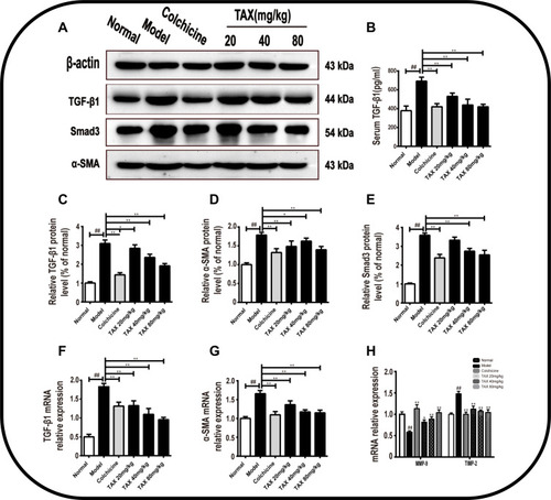 Figure 6 TAX inhibits HSCs activation by regulating TGF-β1/Smads pathway. (A) TAX effect on the expression of α-SMA, TGF-β1, Smad3, and β-actin in mice liver were evaluated by Western blotting; (B) TGF-β1 (pg/mL) in serum; (C–E) Densitometric exploration of Western blotting; (F–H) Relative mRNA intensities of α-SMA, TGF-β1, MMP-9, and TIMP-2. Data explored as the mean±SD (n=10). As compared with the normal group, #P<0.05 indicates a significant difference, ##P<0.01 indicates an extremely significant difference; As compared with the model group, *P<0.05 indicates a significant difference, **P<0.01 indicates an extremely significant difference.